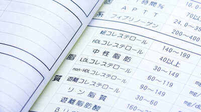 嫌われ者の〈コレステロール〉値が高い人のほうが健康って本当？和田秀樹「薬で値を下げても、動脈硬化が改善するとは限らない」