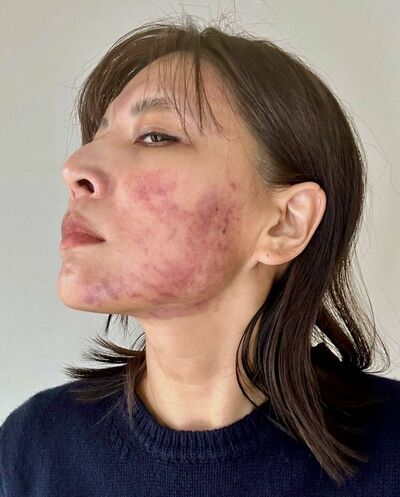 斉藤ナミさん