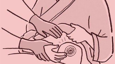 若い頃から排便は週に一度の便秘持ち。ある日、トイレが血に染まり、お腹に激痛が！救急車で運ばれ緊急手術となった病名は――