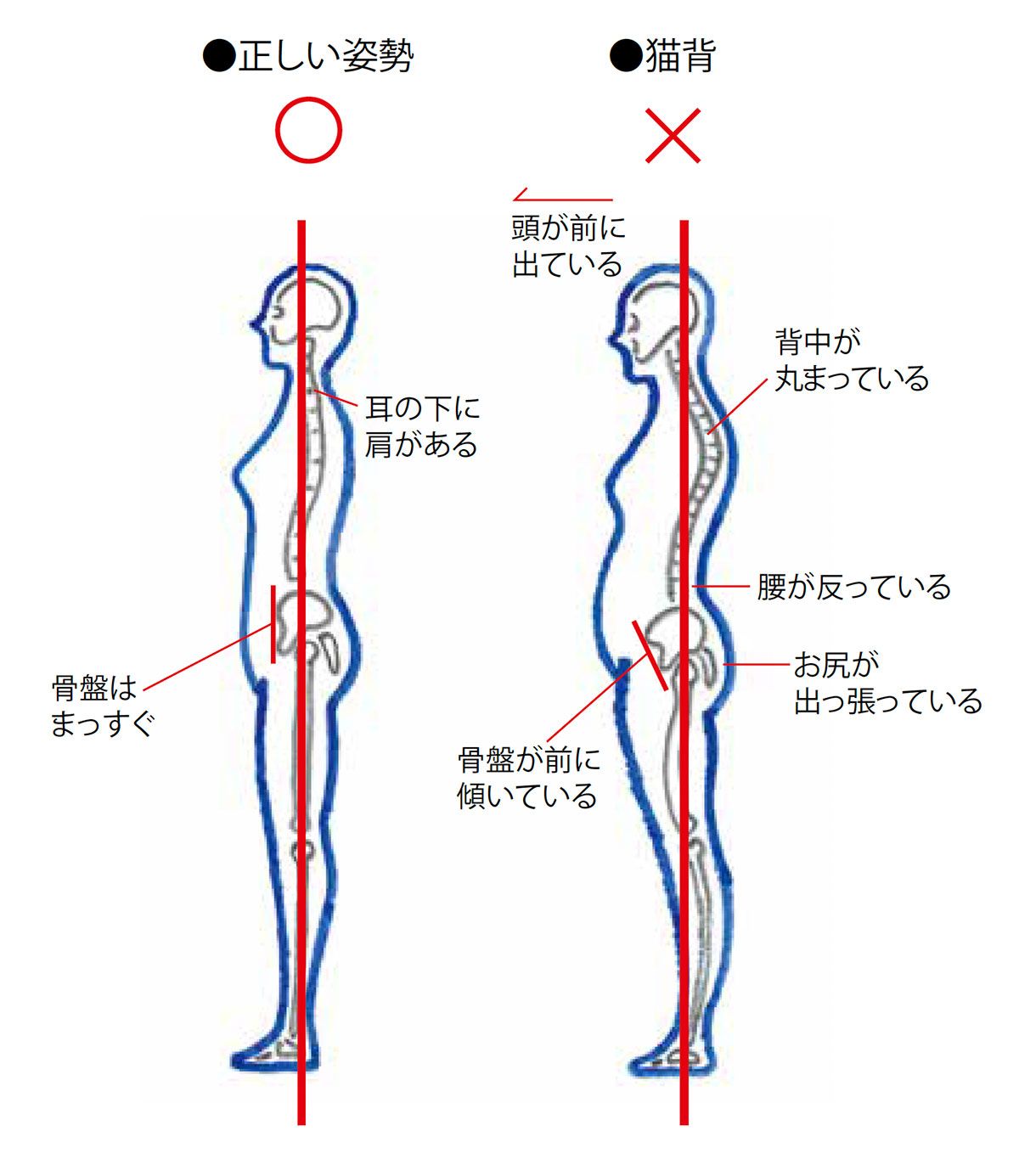 骨盤 の 正しい 位置
