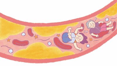 「血管力を高めるには、肉よりも魚？」「血管に負担のかからない運動の始め方は？」血管の専門医が教える新常識