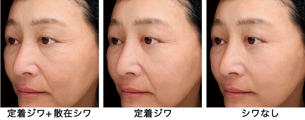 定着ジワ+散在シワ　定着ジワ　シワなし