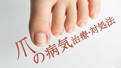 65歳以上の4割以上が爪の水虫「爪白癬」に？「巻き爪」「陥入爪」「肥厚爪」シニア世代に多い足の爪のトラブル《原因と対処法》