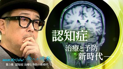 「アミロイドβ」だけじゃない。アルツハイマー病を引き起こす新たな原因が解明？遺伝子の研究で進む予防法の最前線